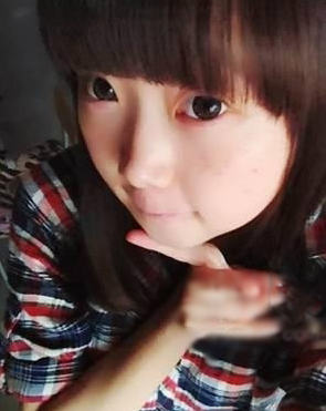 激光去痣 小萝莉美美哒