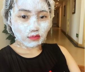 苏州工业园区瑞芙臣医疗美容诊所徐增亮医生丰全脸案例：面部填充 - 珍美网