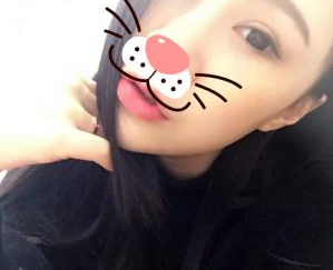 割双眼手术  原来大眼睛这么神奇 美美哒 - 珍美网