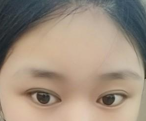三点双眼皮 闪闪的大眼眸真的美翻了 - 珍美网
