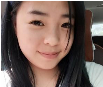 肉毒素瘦脸+垫下巴  完美的脸型我也值得拥有 - 珍美网
