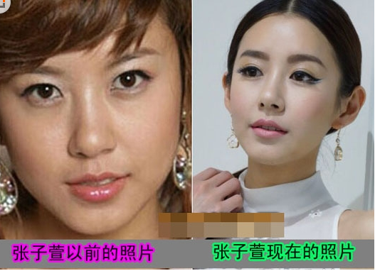 张子萱整形对比照 跟陈赫奉子成婚“辣妈”诞生 实现事业爱情双丰 - 珍美网