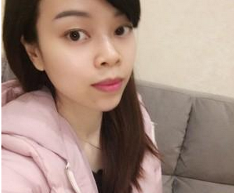 玻尿酸隆下巴  脸部变得柔和让我更加美丽 - 珍美网