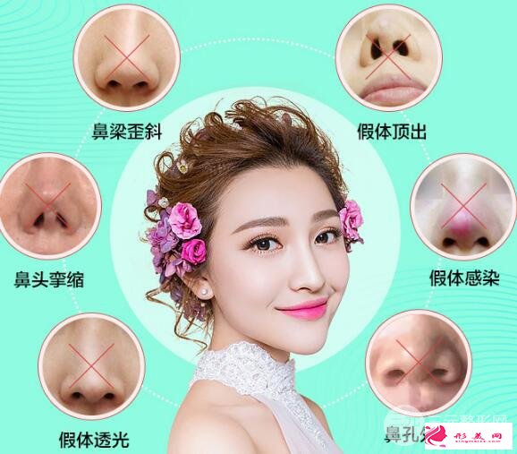 隆鼻失败怎么办？鼻修复手术是怎么做的？