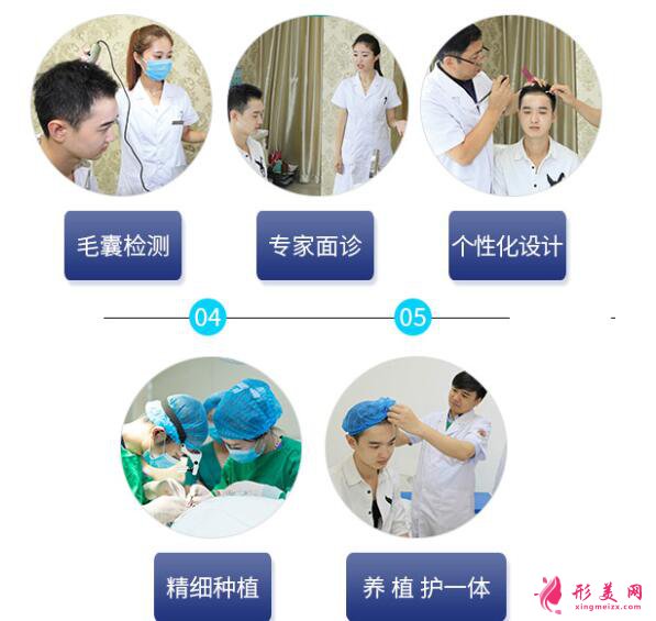 种植头发靠谱吗?