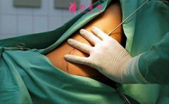 安全有效的减肥方式是什么?有没有副作用？