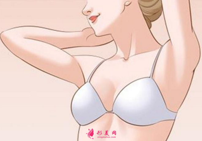 巨乳缩小术后多久能恢复