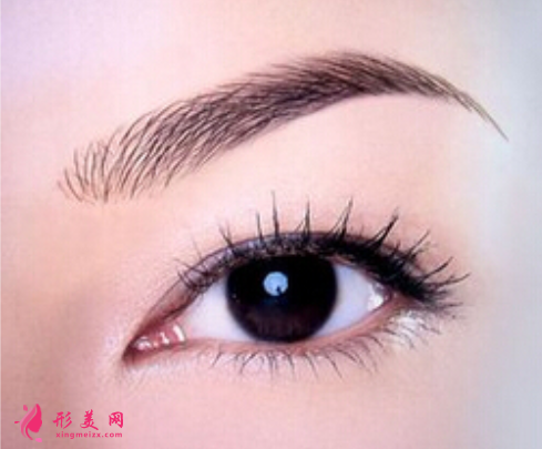 开眼角常见的后遗症