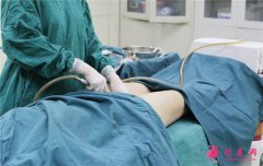 为什么说大腿吸脂不安全？艾恩整形金承俊告诉你真相！