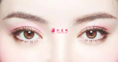 双眼皮术后效果不理想怎么办？