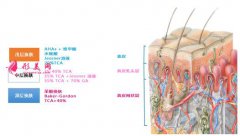 果酸换肤需要多少钱？术后注意事项你都了解吗？