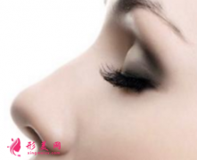 广州隆鼻失败修复手术费用是多少？