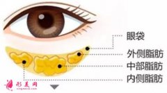 手术祛眼袋的创伤大不大？