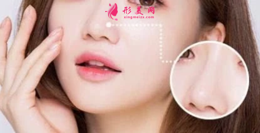 鼻翼缩小手术会有什么风险吗