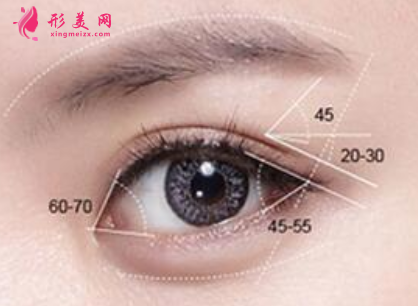 做完开眼角以后还会变小吗