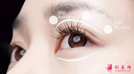 双眼皮整形的费用是多少