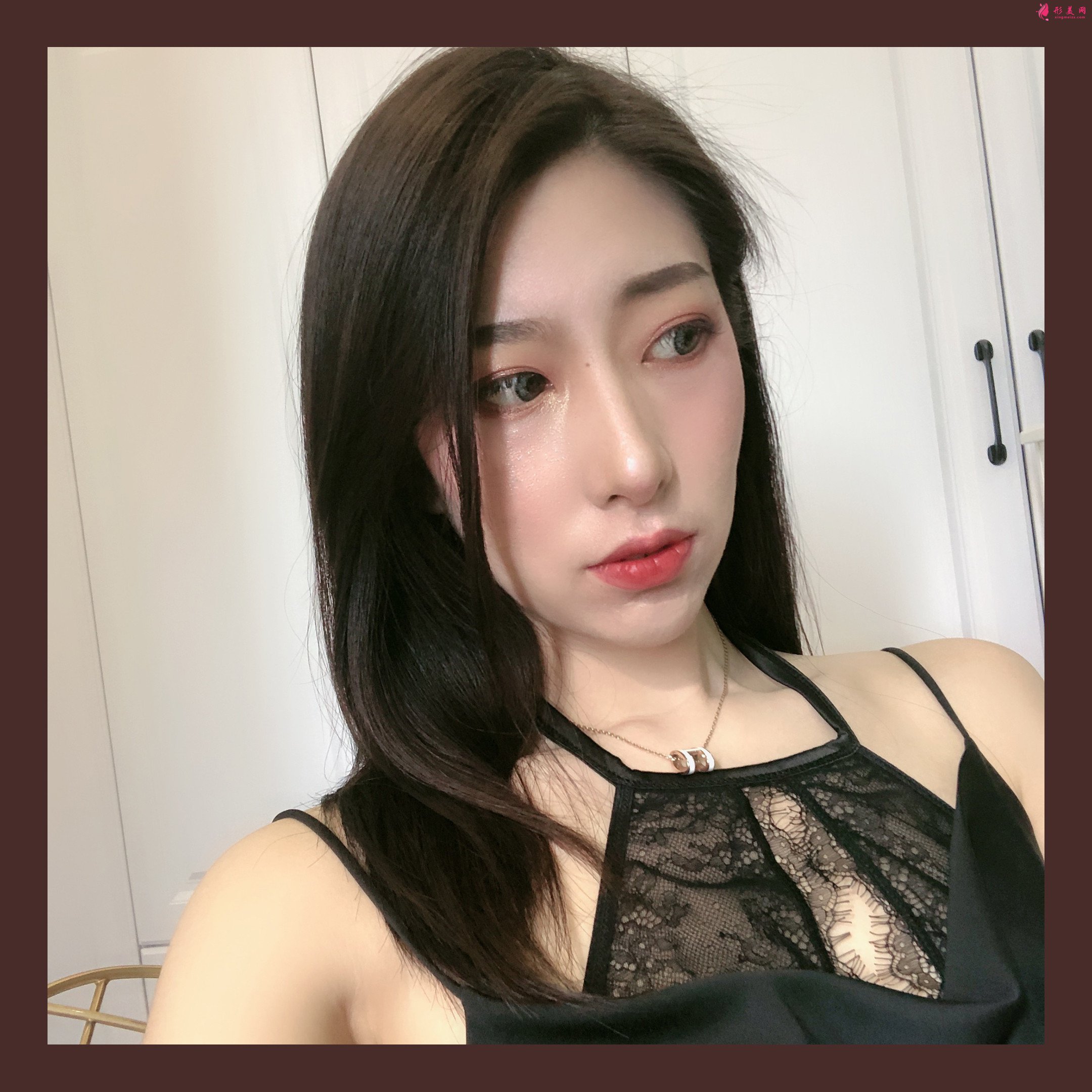 整形后