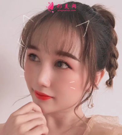 武汉韩辰医疗美容鼻部多项案例 