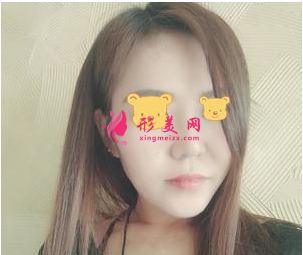 成都成美郑敏做鼻子怎么样? 成都成美郑敏做鼻子怎么样?