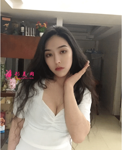 隆胸三个月后