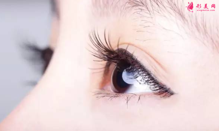 做双眼皮手术比较适合的年龄段