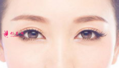 双眼皮整形手术痛吗？