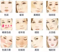 激光祛斑会影响正常上班吗？