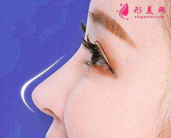 硅胶隆鼻需要多少钱