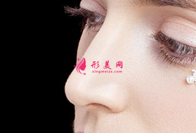 假体隆鼻有什么好处