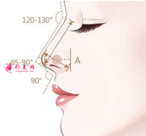 假体隆鼻有什么好处