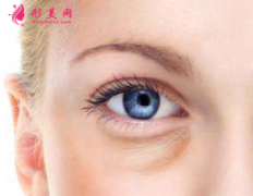 做手术祛眼袋怎样？