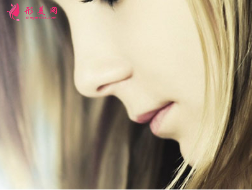 隆鼻假体多久可以取出