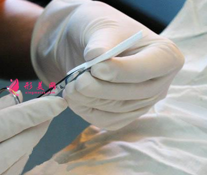膨体隆鼻手术多少钱