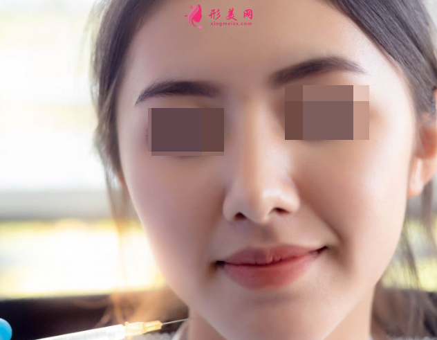 自体脂肪填充脸部可以保持多久