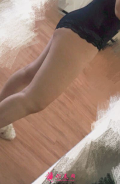 厦门安黛美医疗整形美容大腿吸脂案例