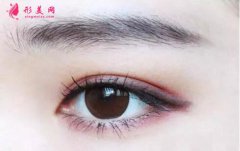 切开双眼皮的价格贵吗？