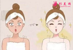 光子嫩肤后的效果好不好？