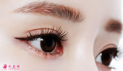 做双眼皮一般得多少钱？