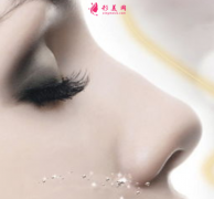 自体软骨隆鼻有什么好处吗？