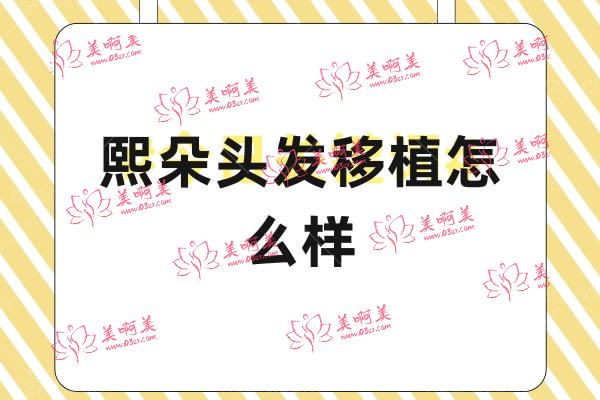 熙朵头发移植怎么样