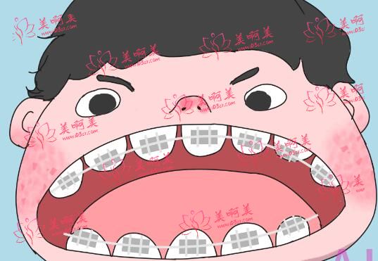 益达口腔怎么样？采用“三次预真空”消毒灭菌技术
