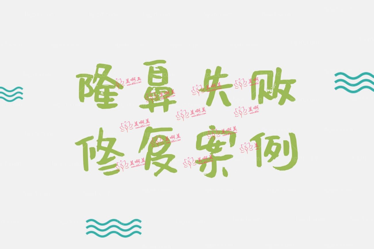 隆鼻失败修复病例.jpg