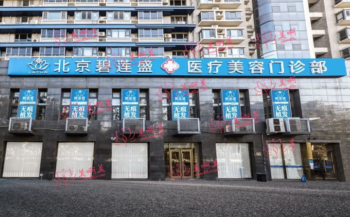 碧莲盛植发医院是私立的吗？怎么样？