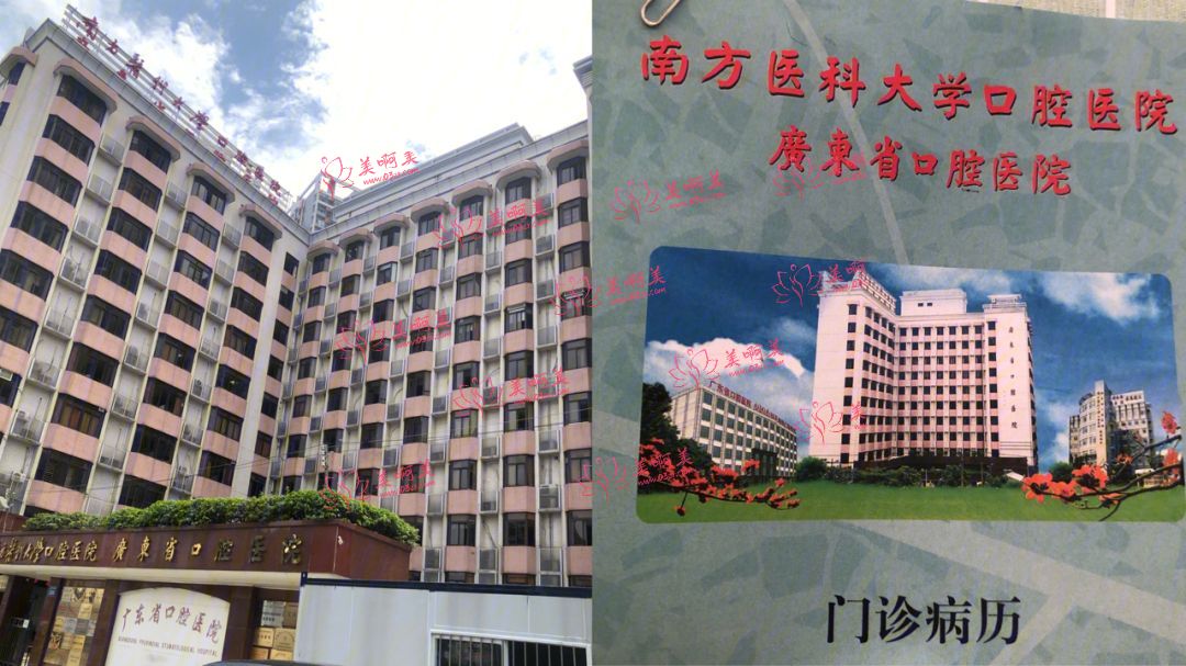 广州口腔医院种植牙、正畸等 的收费情况是怎样的？