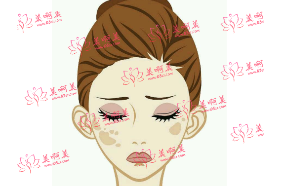 济宁怎样安全去除脸上的色斑？价格的影响因素是？