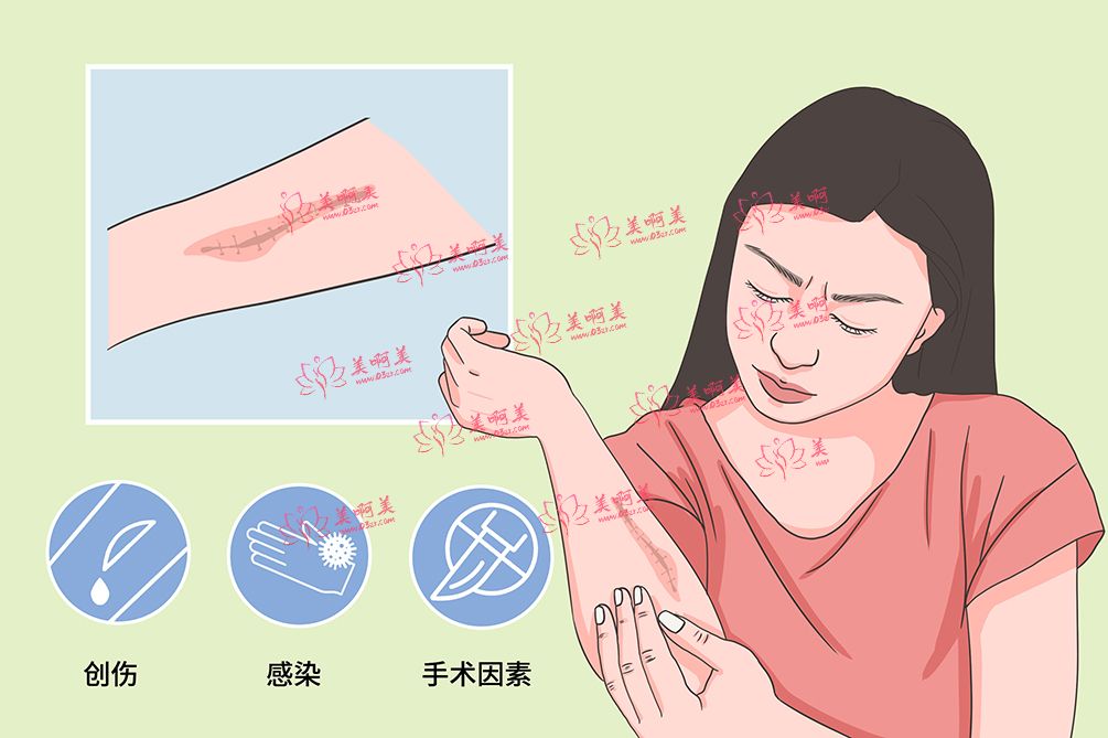 激光祛疤有用吗？在岳阳做激光去疤手术一般要多少钱？