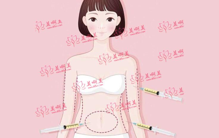 上海长征医院整形科做腰腹吸脂技术好吗?最新案例展示