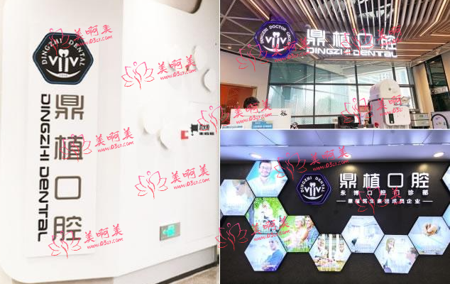 上海宝藏种植牙医院安利——松丰、圣贝、鼎植！便宜技术硬