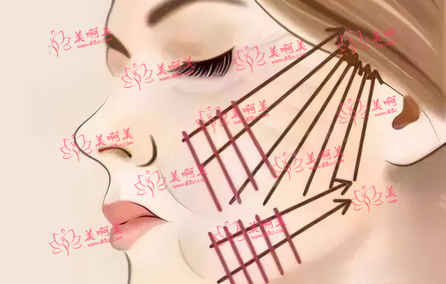 长春皮肤松弛埋线价格，皮肤变白办法