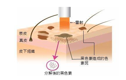 南方医院做点阵激光怎么收费的？价格表|医生资质|美肤案例一览